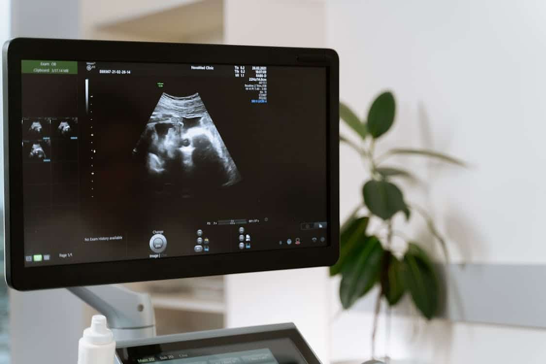 ultrasound technology