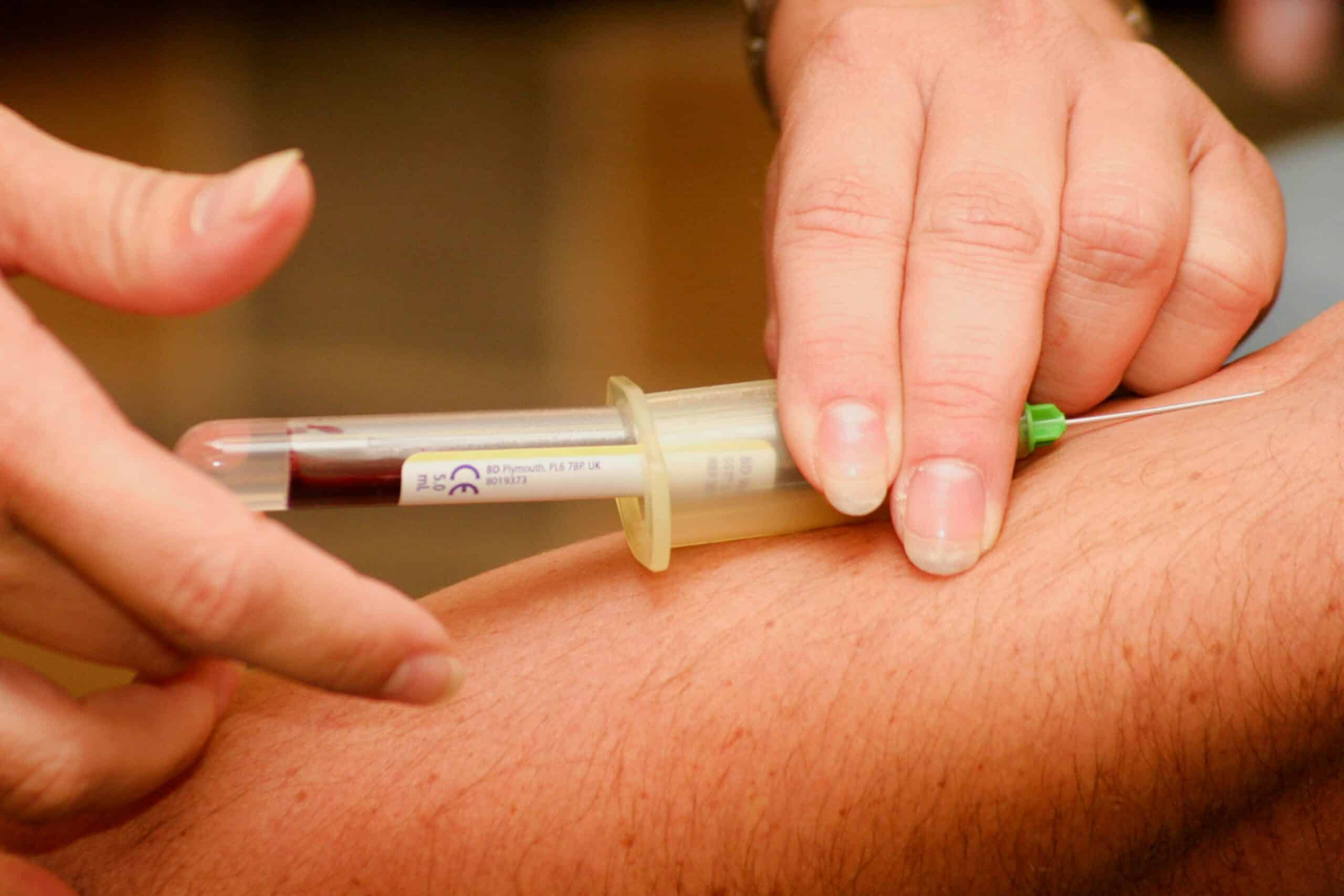 a lab assistant performing a blood test