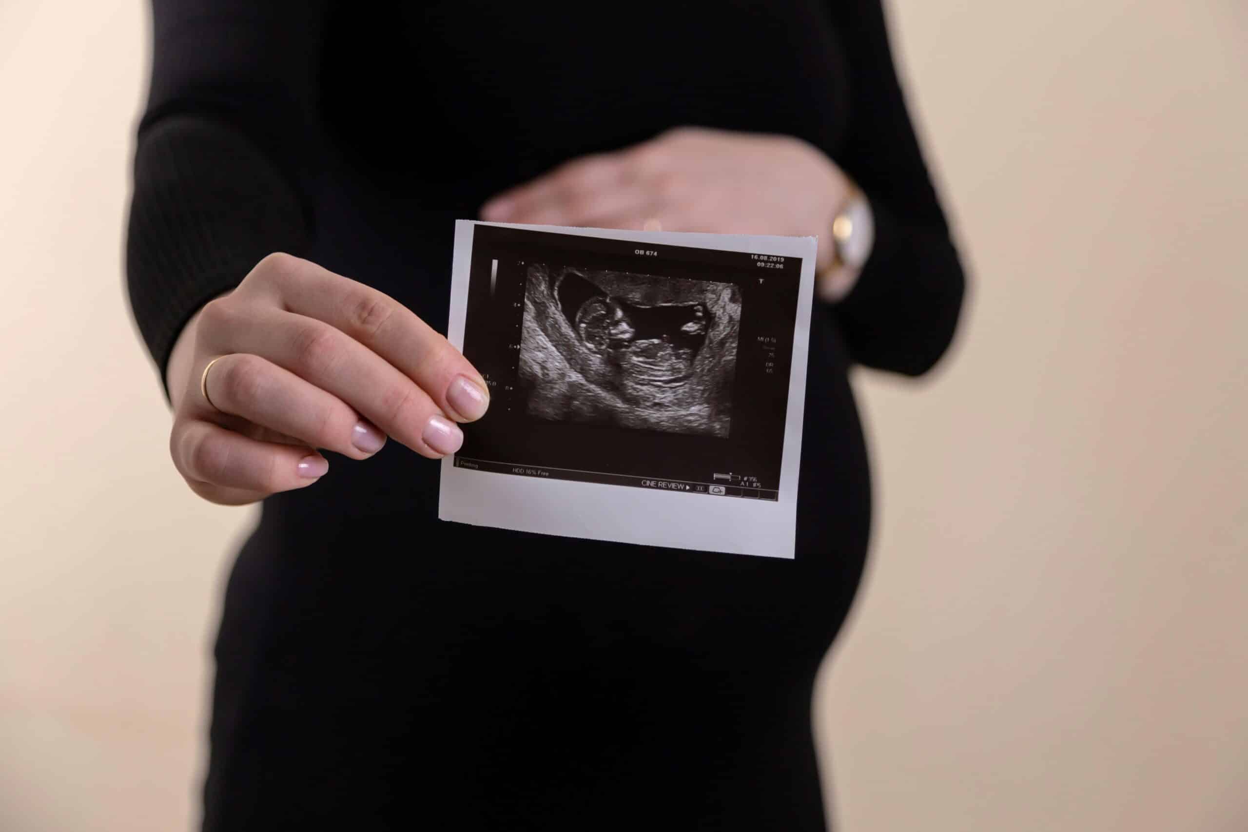 a pregnant woman holding an ultra sound image - Rachael Haverland Site a pregnant woman holding an ultra sound image