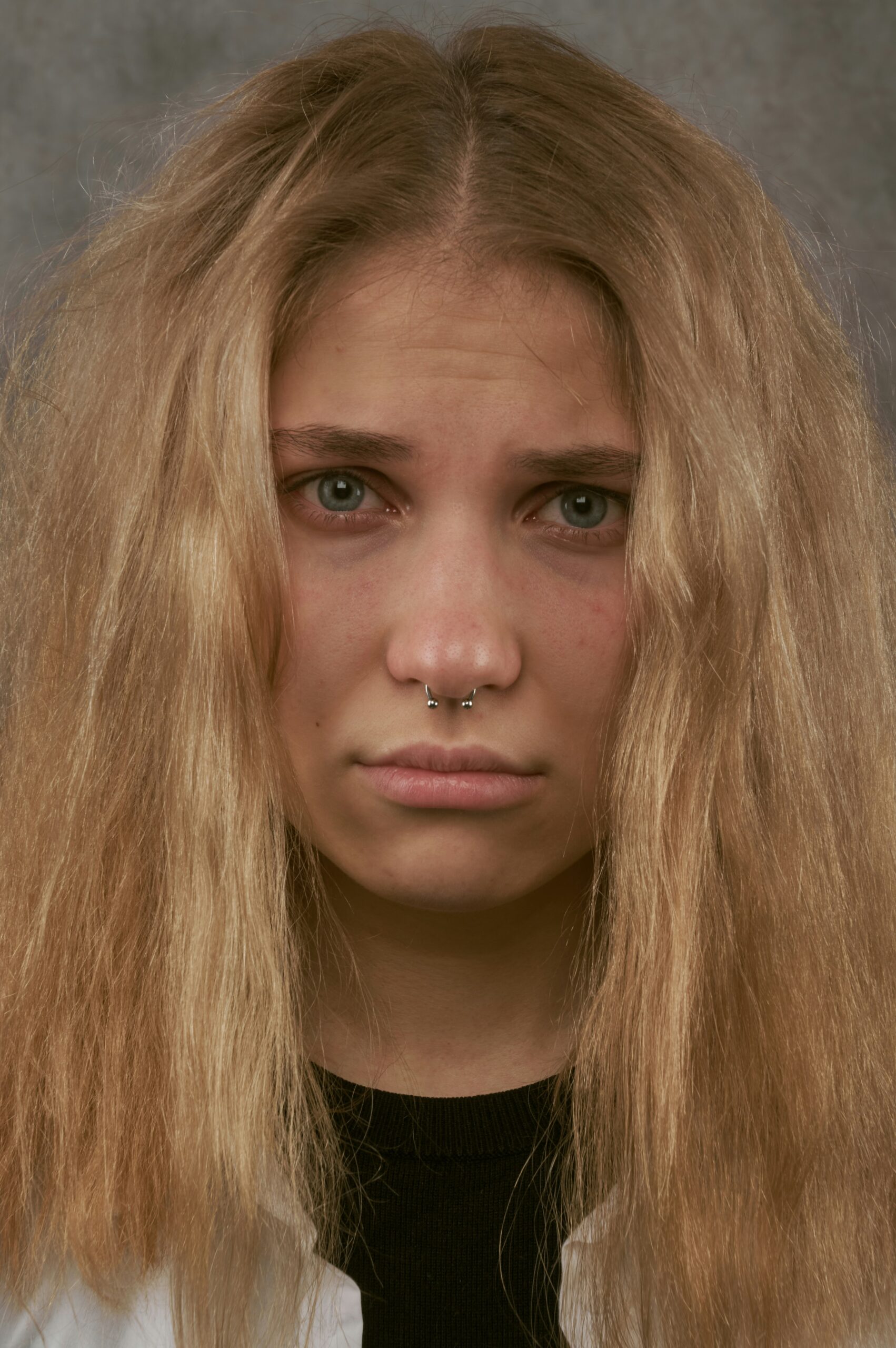 Close-up of a woman with a serious expression, symbolizing the emotional and physical strain caused by hormonal imbalances in endometriosis. - Rachael Haverland Site Close-up of a woman with a serious expression, symbolizing the emotional and physical strain caused by hormonal imbalances in endometriosis.