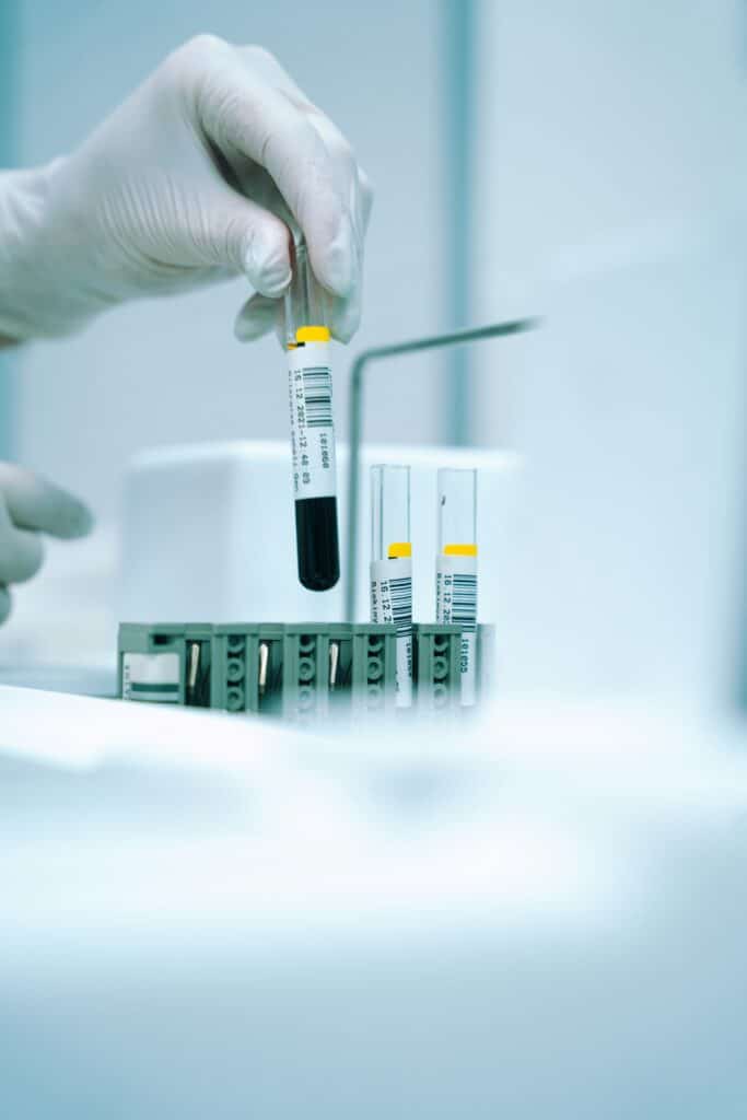 blood test samples in a lab