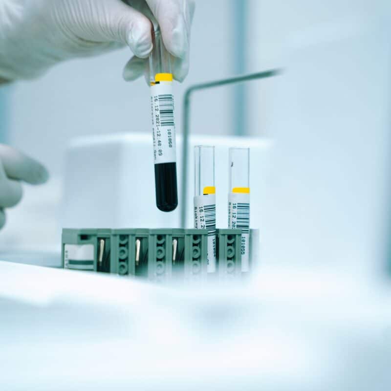 blood test samples in a lab