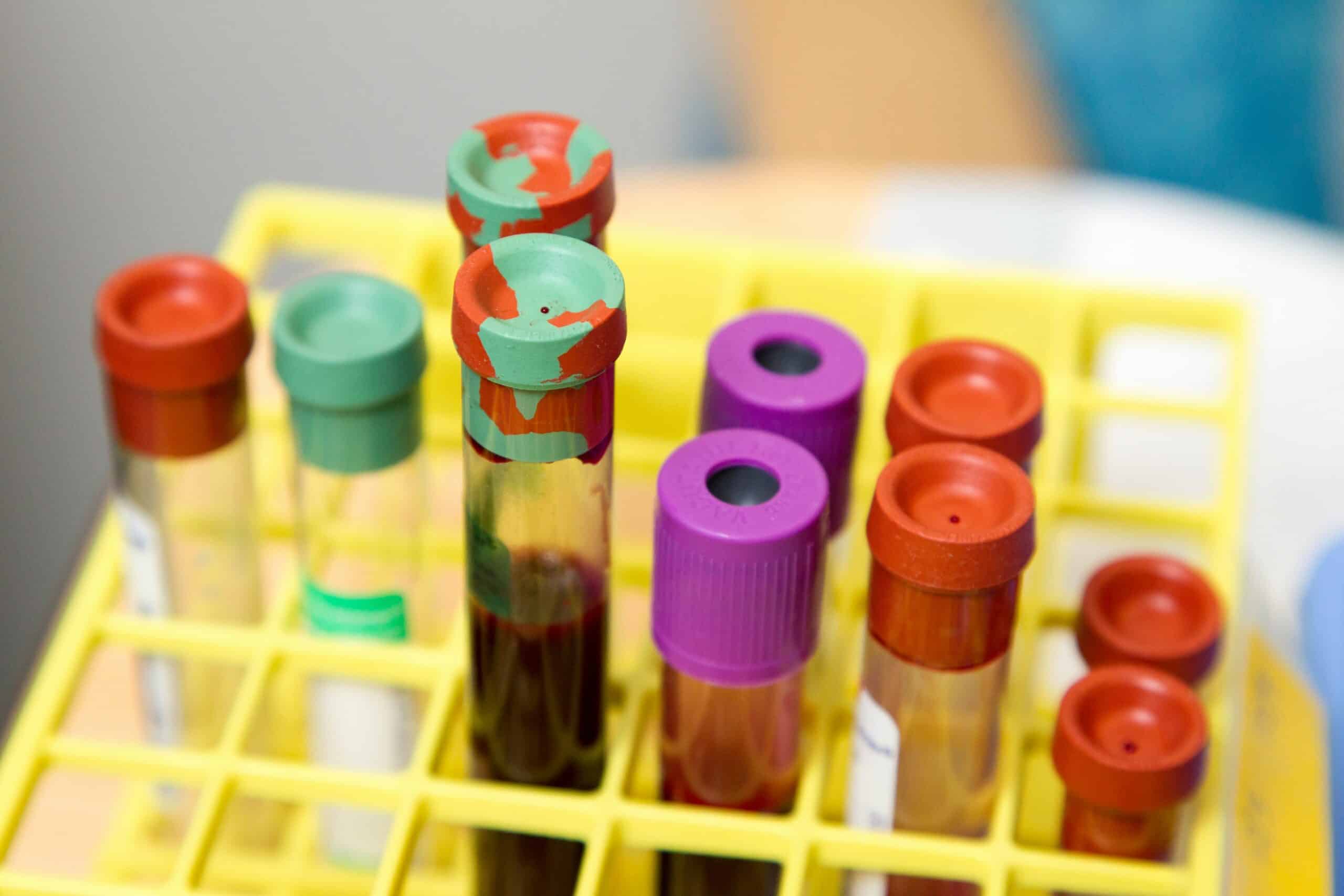 blood test samples