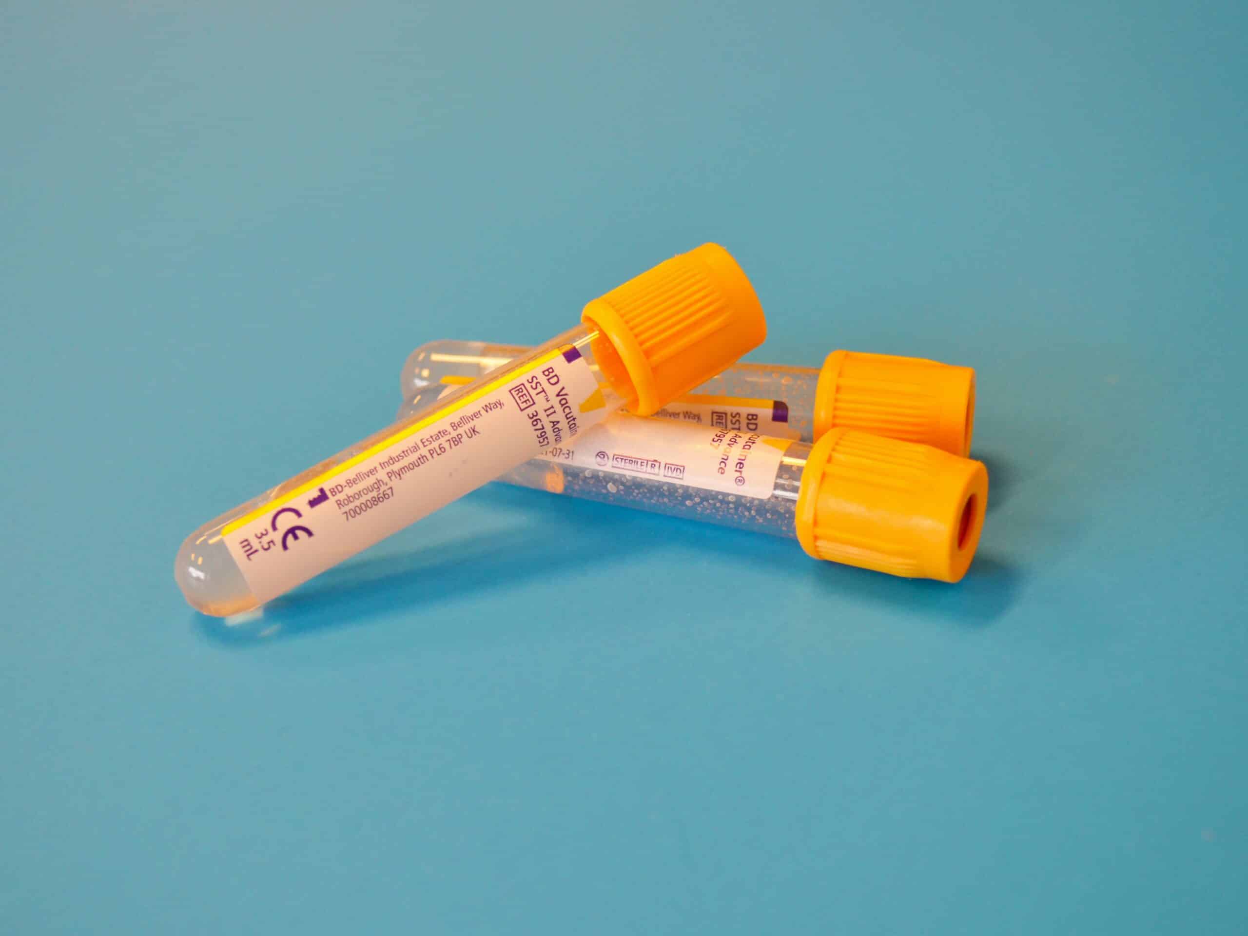 blood test bottles