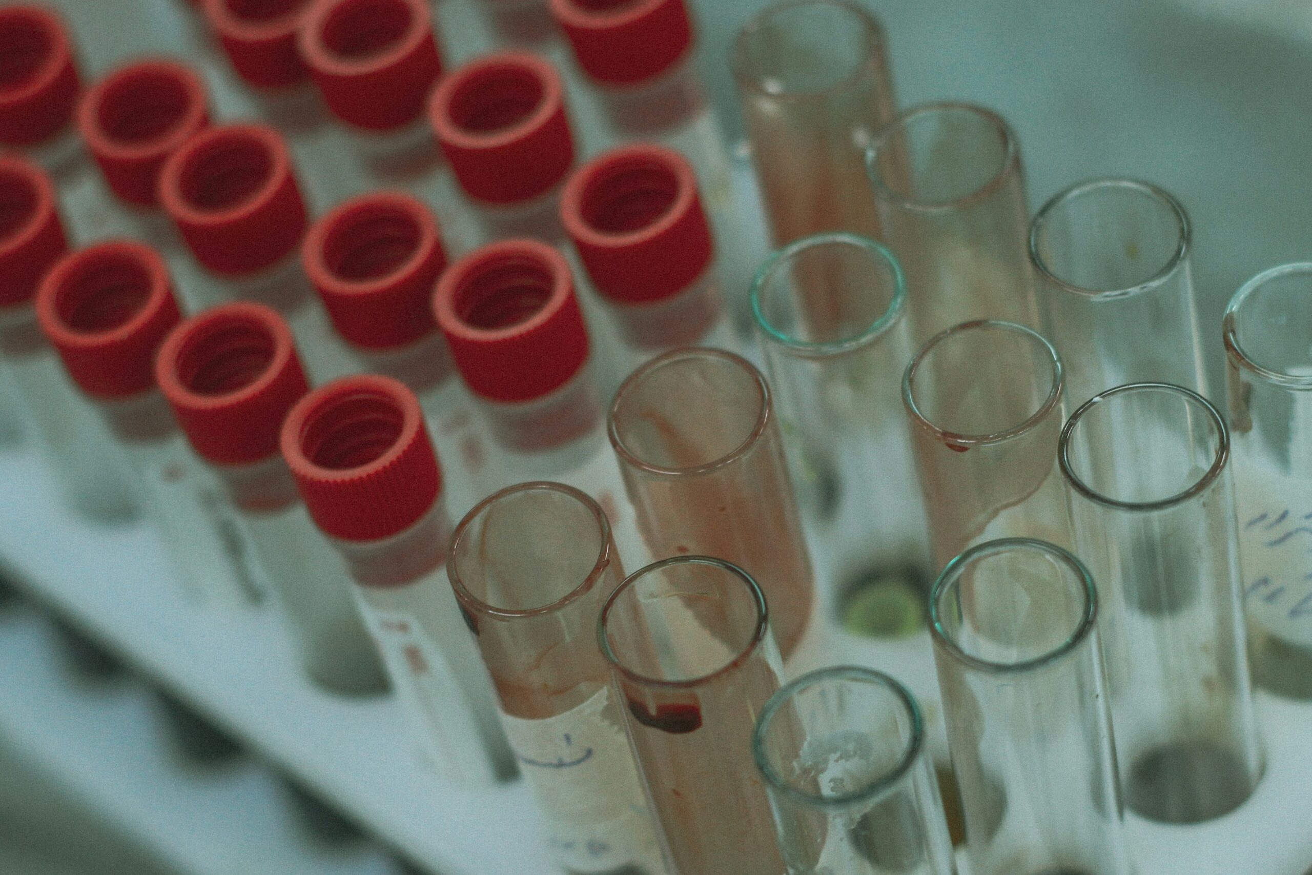 blood test samples