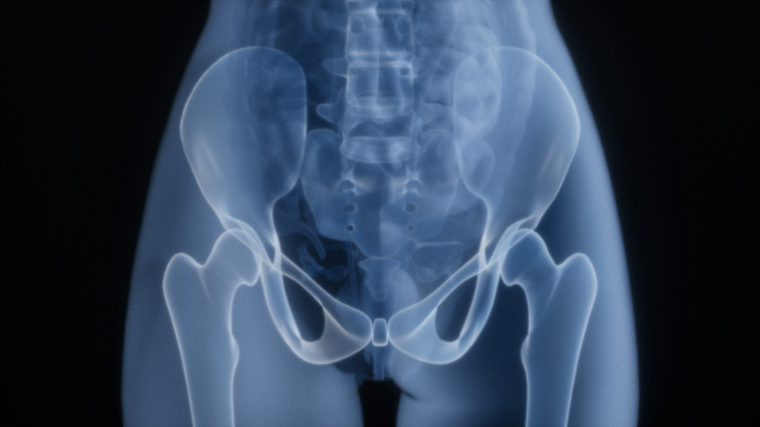 photo 1763198302745 57cb94135f11jpeg - Rachael Haverland Site An X ray of pelvic region