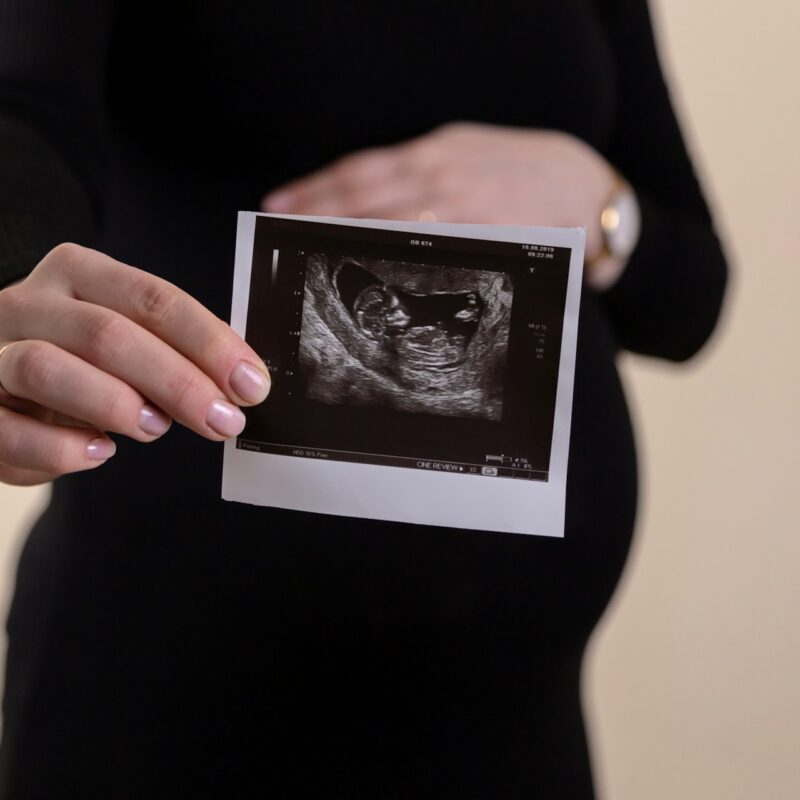 Pregnant woman