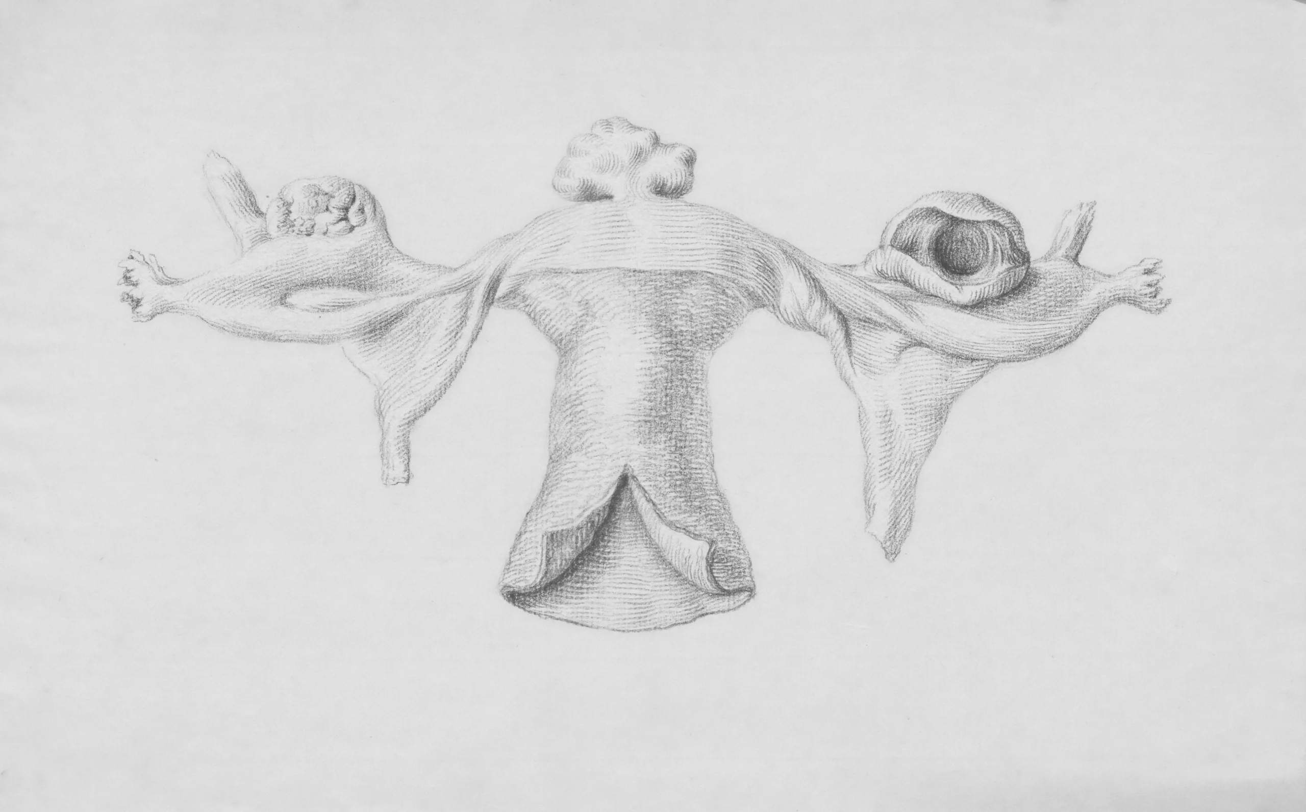 Medical diagram showing stages of endometriosis progression