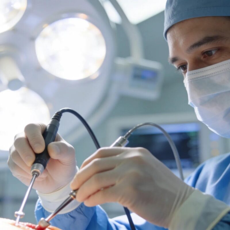 Surgeon performing laparoscopic surgery showcasing advanced techniques for treating bowel endometriosis