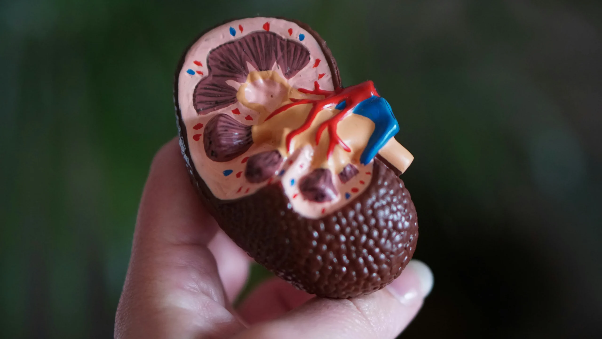 Diagram showing how ureteral endometriosis can affect kidney function