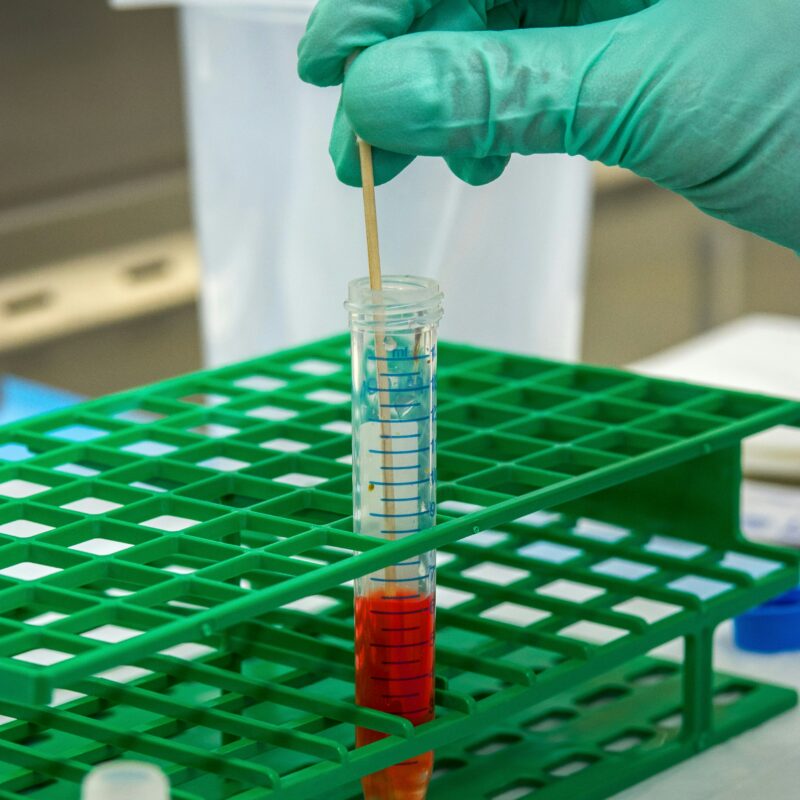 a blood test sample